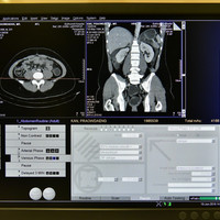 เครื่อง MRI รูปภาพ 33