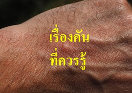 เรื่องคันที่ควรรู้ พารามิเตอร์รูปภาพ 1