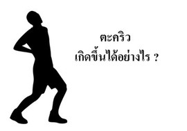 ตะคริว เกิดขึ้นได้อย่างไร ? รูปภาพ 1