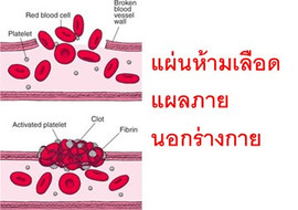 แผ่นห้ามเลือดแผลภายนอกร่างกาย รูปภาพ 1