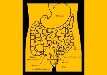 การตรวจหา hTERT mRNA ... พารามิเตอร์รูปภาพ 1