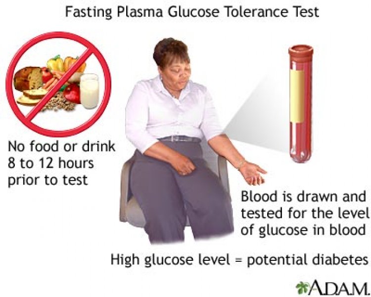 Curva de tolerancia a la glucosa valores normales
