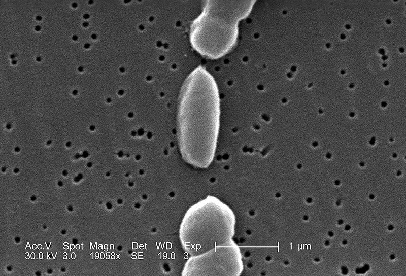 V. parahaemolyticus (SEM)