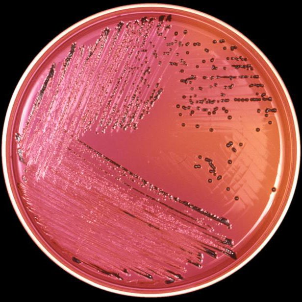 Salmonella on agar