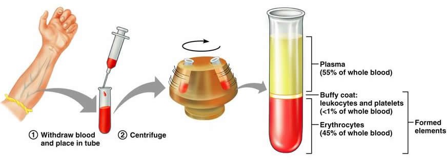 Компоненты сыворотки крови. Центрифугирование крови для получения сыворотки плазмы. Плазма крови после центрифугирования. Слои крови после центрифугирования. Разделение крови центрифугированием.