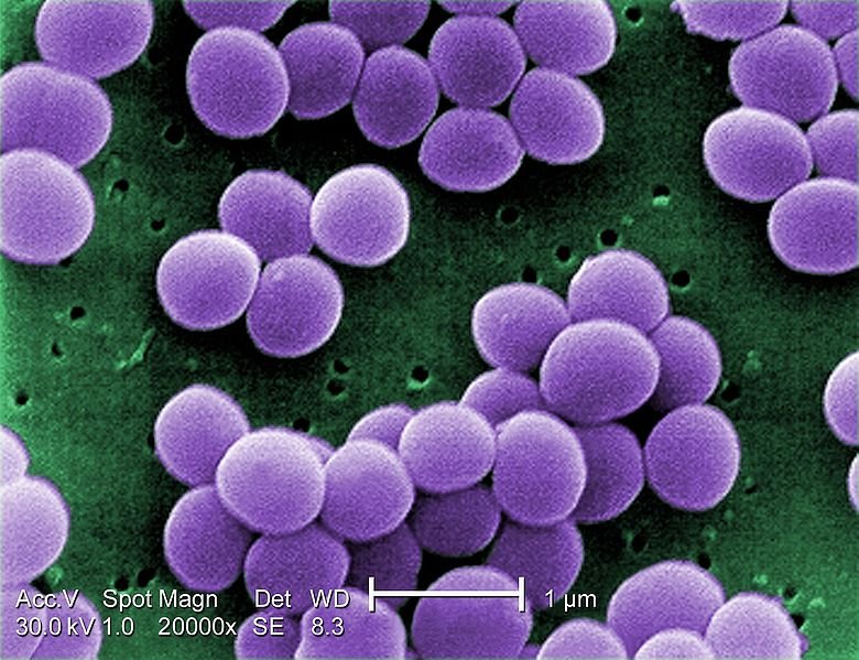แสดงภาพเชื้อ S. aureus แบคทีเรียชนิดแกรมบวกรูปทรงกลม ที่ติดสีม่วงบน vancomycin intermediate resistant culture (VISA) ภายใต้กล้องอิเล็คตรอนไมโครสโคป (SEM) ที่กำลังขยาย 20000 เท่า