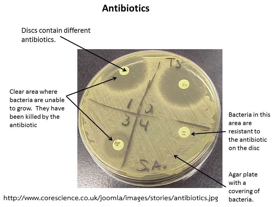 จุลชีววิทยา (Microbiology)